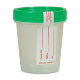 Sterile Specimen Collection Container